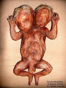 [Gambar: two-headed-baby.jpg]